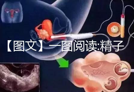 【圖文】一圖閱讀:精子和卵子結(jié)合有多難！