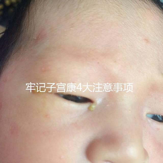 牢記子宮康4大注意事項，輕松避免胃脹、腹瀉等副作用