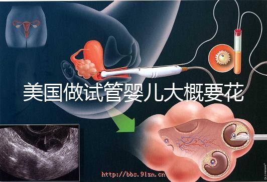 美國做試管嬰兒大概要花多少錢？具體支出25w！