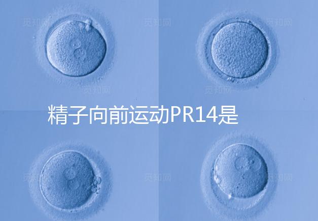 精子向前運動PR14是否正常聽專家怎么說，當心弱精找上門