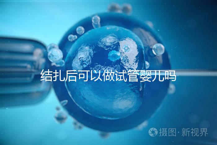 結扎后可以做試管嬰兒嗎(結扎后可以做試管嬰兒嗎費用多少錢)