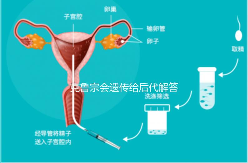 克魯宗會遺傳給后代解答嗎？他生來就有一篇清晰的文章嗎？