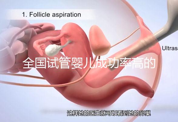 全國試管嬰兒成功率高的醫院有哪些?(全國試管嬰兒成功率高的醫院目錄一覽)