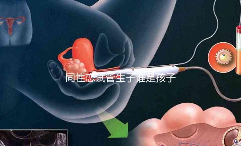 同性戀試管生子誰是孩子爸惹爭議!血緣關(guān)系竟成迷