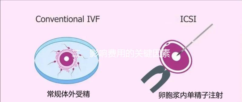 二、影響費用的關鍵因素