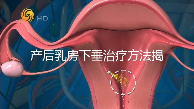 產后乳房下垂治療方法揭秘,按摩手法再好也沒提前預防有用