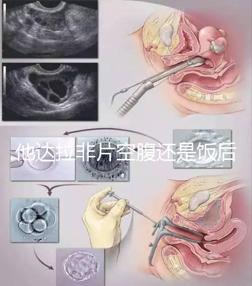 他達拉非片空腹還是飯后吃看這,控制好用藥時間效果佳
