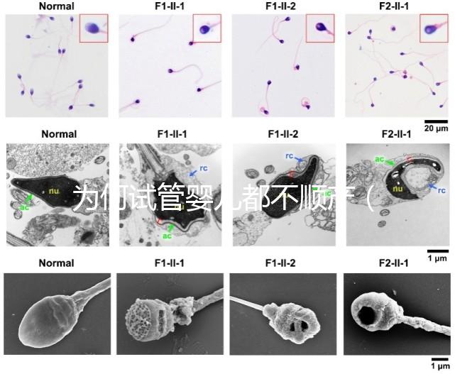 為何試管嬰兒都不順產(為何試管嬰兒都不順產呢)