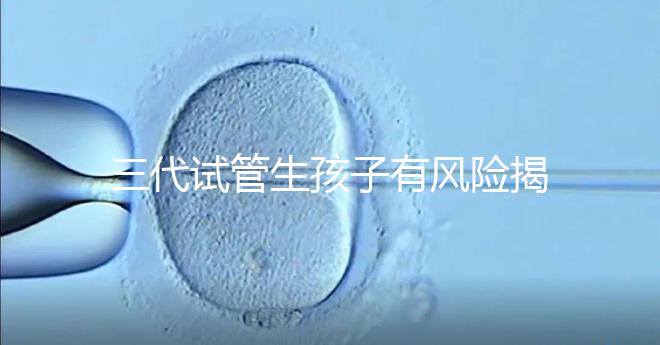 三代試管生孩子有風(fēng)險揭秘嗎?嬰兒會有問題嗎?