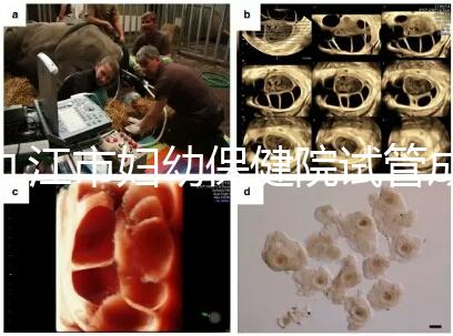 九江市婦幼保健院試管成功率高、費(fèi)用低?生殖醫(yī)生揭開真相