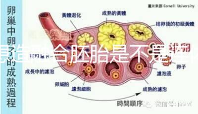 想造融合胚胎是不是連體嬰兒看這，容不容易雙胎一文講清