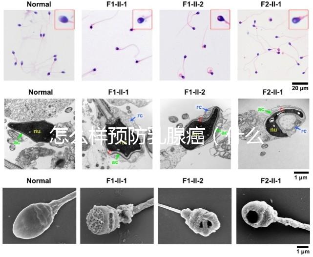 怎么樣預(yù)防乳腺癌(什么人容易得乳腺癌)