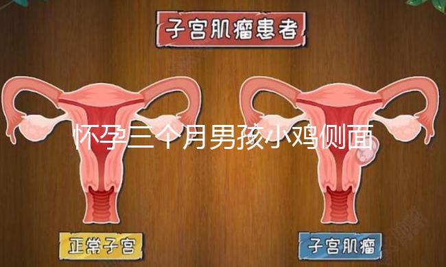 懷孕三個(gè)月男孩小雞側(cè)面二維b超圖片分享，原來(lái)兩腿間有尖