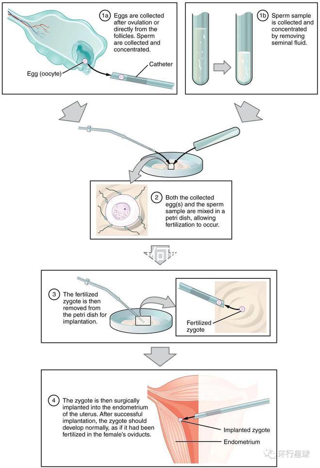 懷孕期間如何降血糖效果更好？