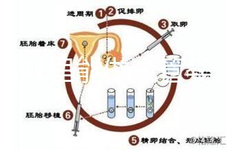 文昌哪里能做試管嬰兒？國內做一次成功率有多高？