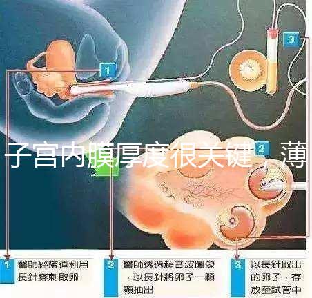 子宮內膜厚度很關鍵，薄了厚了試管嬰兒都難成功
