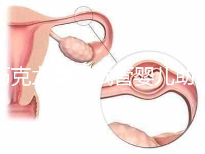 巧克力囊腫試管嬰兒助孕應先治療？網友看法均有差異
