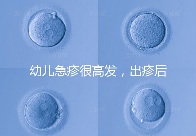 幼兒急疹很高發(fā)，出疹后的護理方法及注意事項提前知曉！