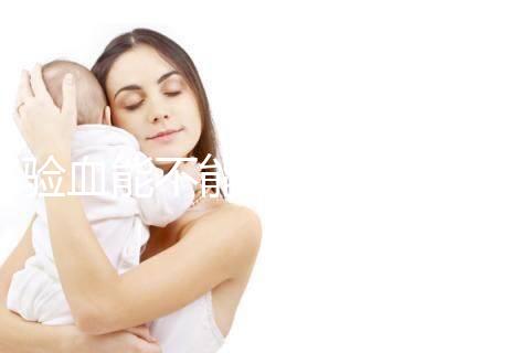 驗(yàn)血能不能檢查出來是否懷孕