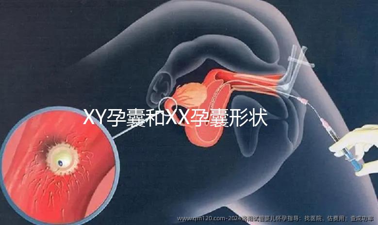 XY孕囊和XX孕囊形狀各有差異，橢圓形可能是懷女哦！