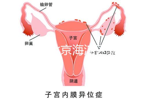 2024年北京海淀區新生兒醫療保險處理策略,照片要求不要出錯