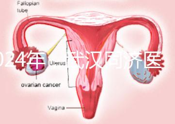 2024年，武漢同濟醫院不孕癥醫生排名公布，選擇專家迅速登記
